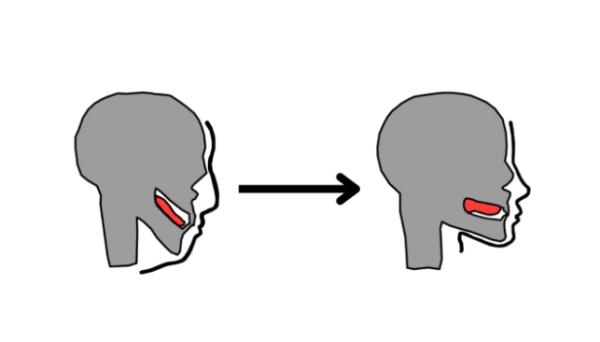 The supposed results of “mewing” promise to alter your bone structure to give you a better-looking appearance. Many apparent “before and after” images shown online claim to provide such results despite seeming implausible.